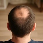 Судьба по макушкам: как в народных приметах читают число вихров на голове